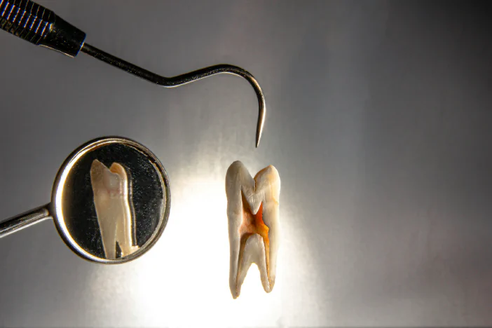 Missing Tooth Replacement Options: What Works for Different Situations