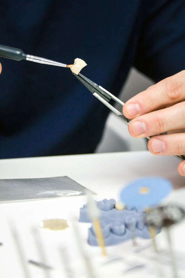 Dental Crown Costs and Types UK: What You Need to Know in 2025